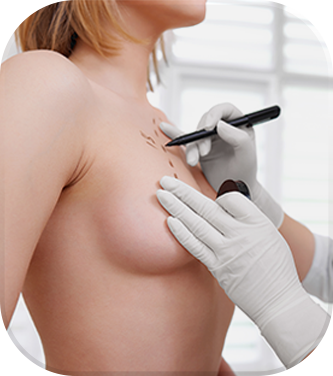 Doctor marking area around the breasts with a pen