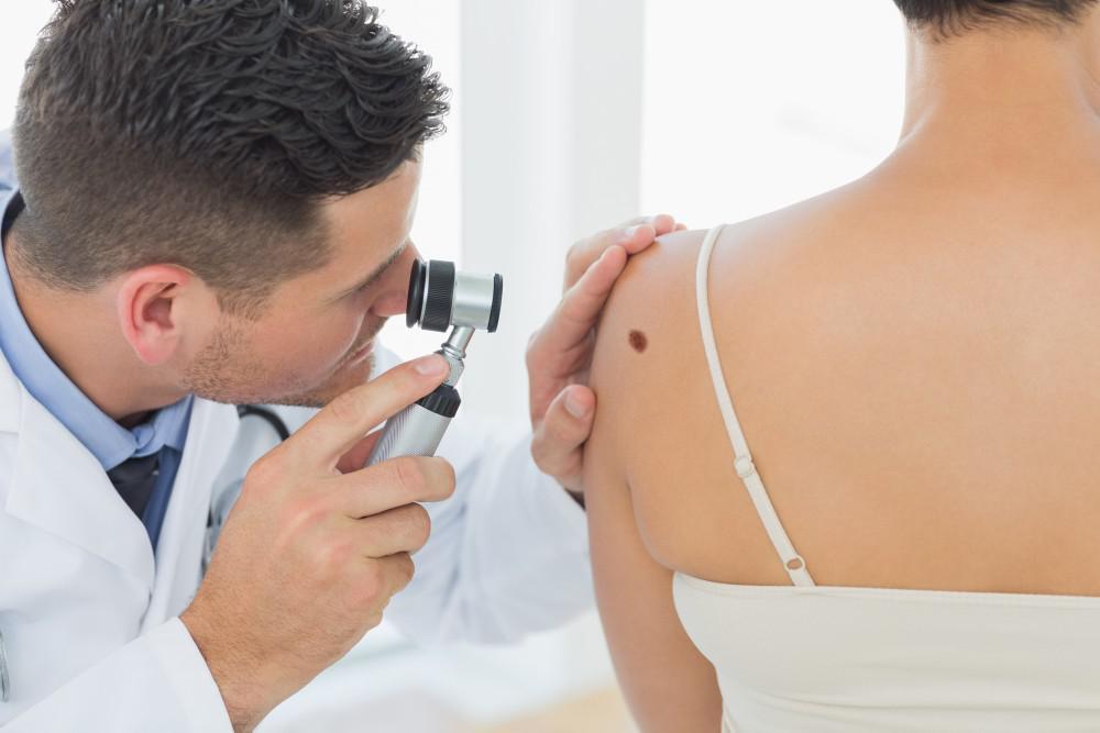 Diagnosis of Melanoma