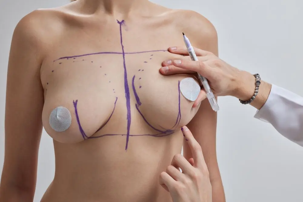 breast reduction